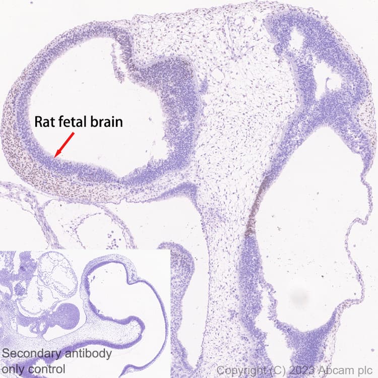 Arx Antibody Epr27481 32 Ab308260  Immunohistochemistry Formalin Pfa Fixed Paraffin Embedded Sections Img408870