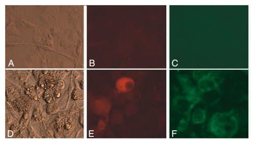 LDL Uptake Assay Kit (Cell-Based)(AB133127)