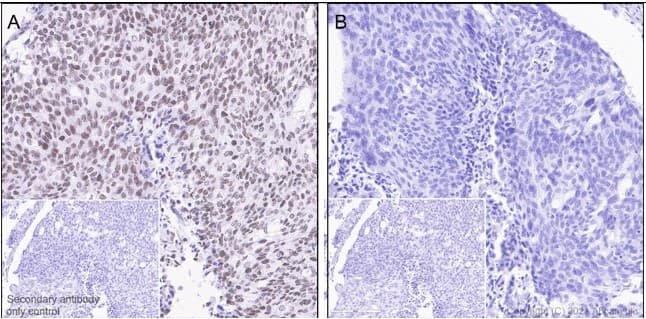 Anti-JAK2 (phospho Y1007 + Y1008) antibody [E132](AB32101)