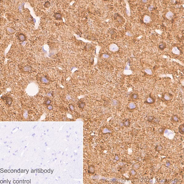 Anti-alpha Tubulin acetyl K40 antibody [EPR16772] - Rat IgG2a (Chimeric)(AB289863)