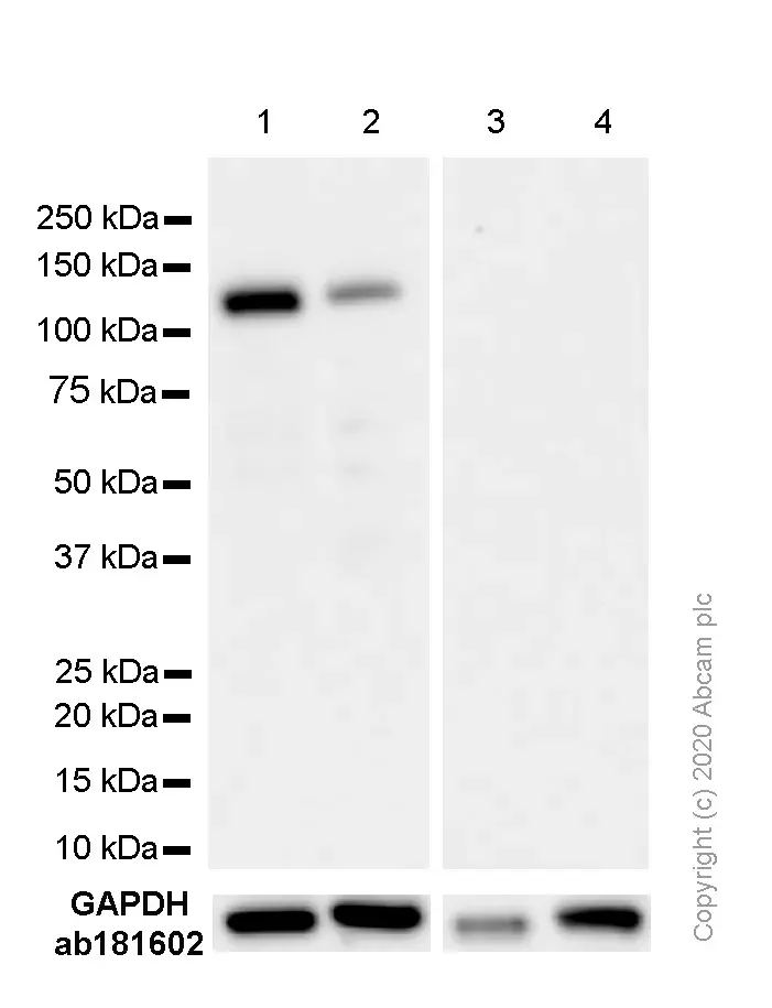 Anti-Androgen Receptor antibody [EPR1535(2)](AB133273)