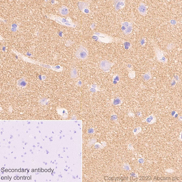 Anti-Alpha-synuclein antibody [MJFR1] - Mouse IgG2a (Chimeric)(AB309157)