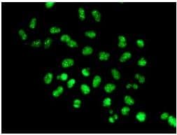 Anti-Nuclear Matrix Protein p84 antibody [EPR5662(2)] - BSA and Azide free(AB232034)