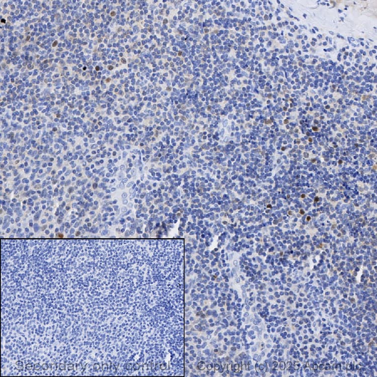 Anti-Cdk2 antibody [E304](AB32147)