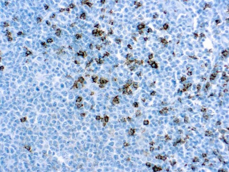 Anti-CD8 alpha antibody [C8/144B](AB17147)