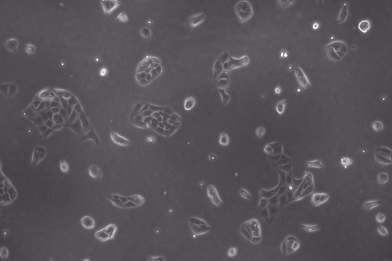 Lmd Hela Cells 05 Kid21766572