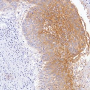 Anti-TROP2 antibody [SP293] - BSA and Azide free(AB272014)