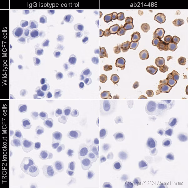 Trop2 Antibody Epr20043 Ab214488 Immunohistochemistry Formalin Pfa Fixed Paraffin Embedded Sections Img439911