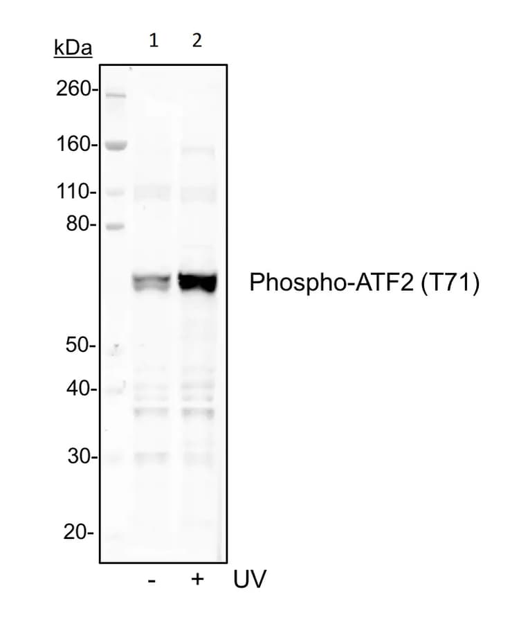 Atf2 Phospho T71 Antibody Atf2t71 G3 Ab278689  Western Blot Img73435