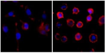 Phosphotyrosine Antibody Rm111 Ab190824  Immunocytochemistry Immunofluorescence Img12566