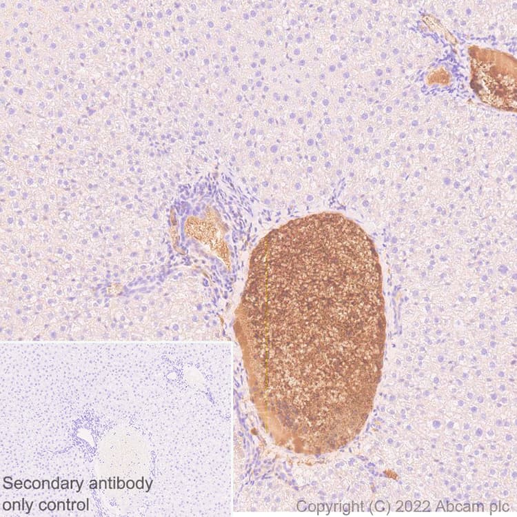 Complement Factor B Antibody Epr27443 6 Bsa And Azide Free Ab309150  Immunohistochemistry Formalin Pfa Fixed Paraffin Embedded Sections Img409467