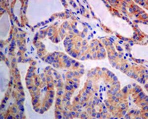 Anti-GBA antibody [EPR5143(3)] - BSA and Azide free(AB215260)