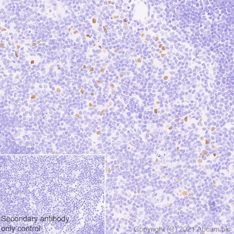 Aire Antibody Epr24411 22 Bsa And Azide Free Ab283663  Immunohistochemistry Formalin Pfa Fixed Paraffin Embedded Sections Img165910