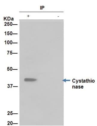 Cystathionase Cth Antibody Epr15468 N Terminal Ab189916  Immunoprecipitation Img109015