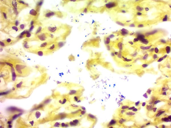 Gram Stain Kit (Microorganism Stain)(AB150672)