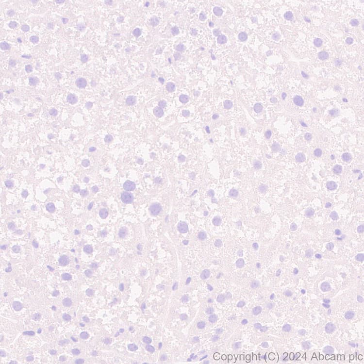 Anti-VAChT antibody [EPR29154-71](AB317452)