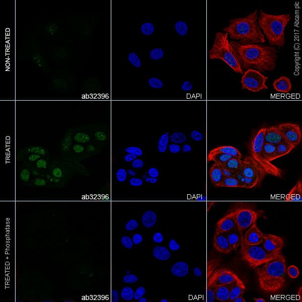 Estrogen Receptor Alpha Phospho S118 Antibody E91 Ab32396  Immunocytochemistry Immunofluorescence Img91086