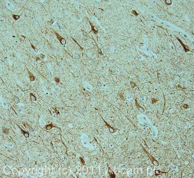 68kda Neurofilament Nf L Antibody Da2 Ab7255  Immunohistochemistry Formalin Pfa Fixed Paraffin Embedded Sections Img132451