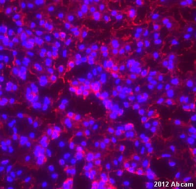 Anti-Transportin 1/MIP antibody [D45](AB10303)