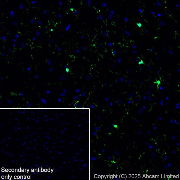 Anti-Iba1 antibody [EPR16589](AB178847)