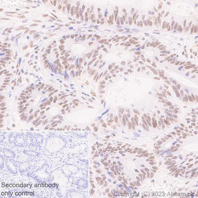 Anti-METTL16 antibody [EPR27236-78](AB313743)