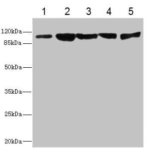 Anti-Desmocollin 2 antibody(AB230039)