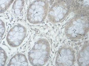 B3galnt1 Antibody Ab176891  Immunohistochemistry Formalin Pfa Fixed Paraffin Embedded Sections Img50488