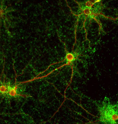 Synaptophysin Antibody Synaptic Marker Ab32594  Immunocytochemistry Immunofluorescence Img23831