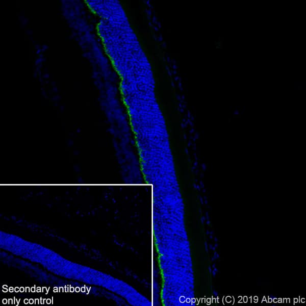 Anti-PSD95 antibody [EPR23124-118] - Synaptic Marker(AB238135)