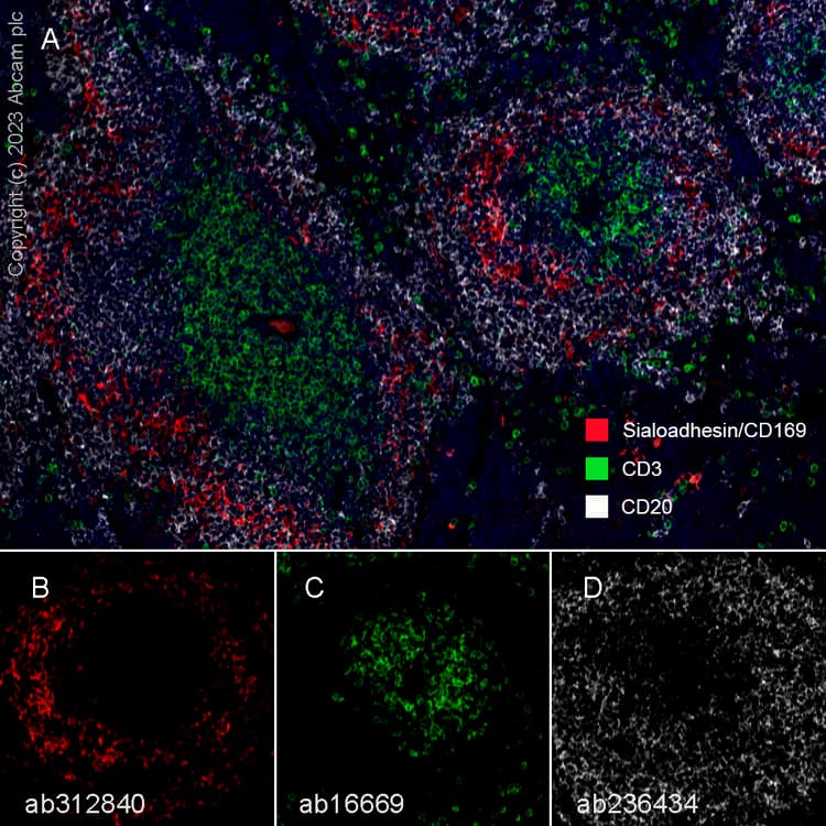 Anti-CD20 antibody [SP32](ab64088)