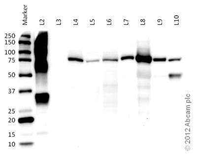 Anti-CPT1A antibody [8F6AE9](AB128568)