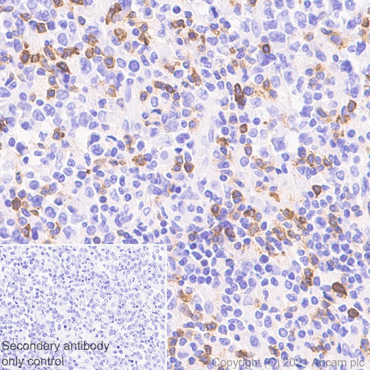 Cxcr6 Antibody Epr24686 113 Bsa And Azide Free Ab281934  Immunohistochemistry Formalin Pfa Fixed Paraffin Embedded Sections Img169174