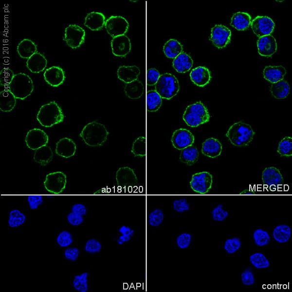 Anti-CXCR4 antibody [EPUMBR3](AB181020)