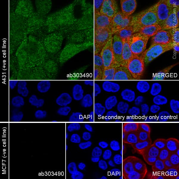 Anti-IL-1RA antibody [EPR26853-58](AB303490)
