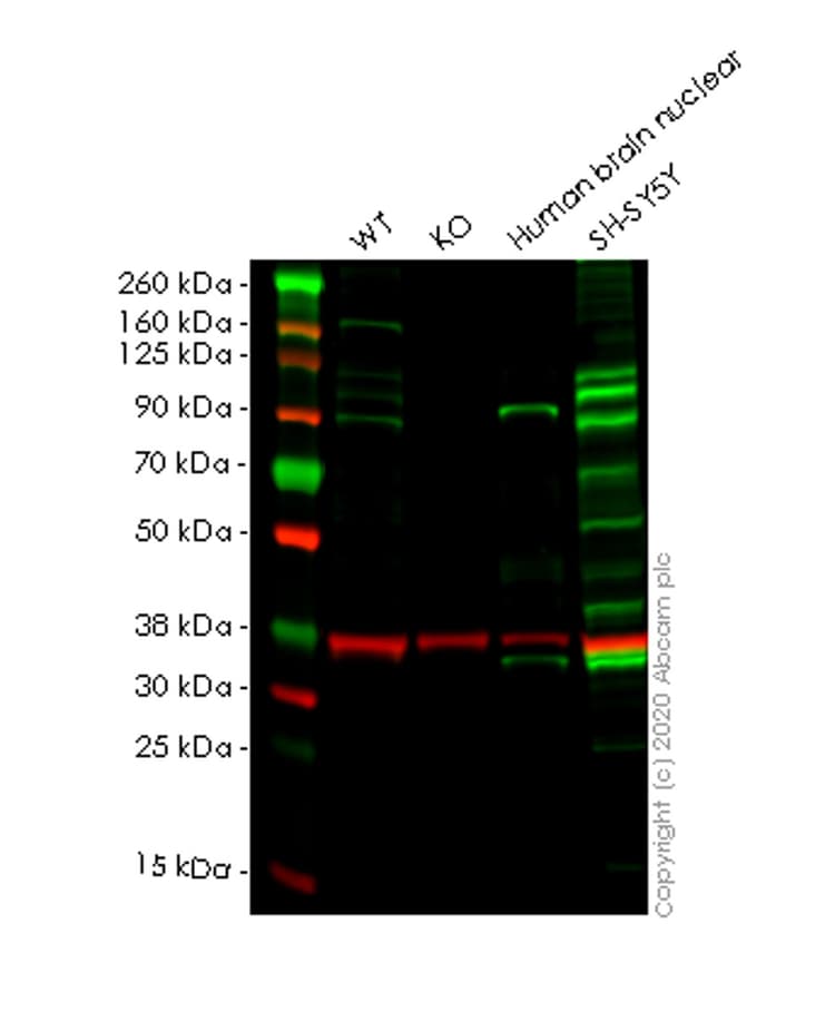 Git1 Antibody Epr10368 Ab171956  Western Blot Img2256