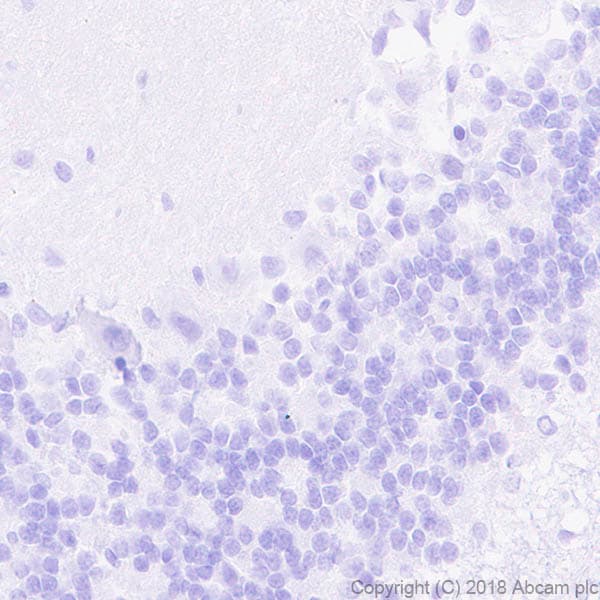 Anti-ETS2 antibody [EPR22419](AB219948)
