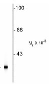 Anti-PGP9.5 antibody [BH7](AB72911)