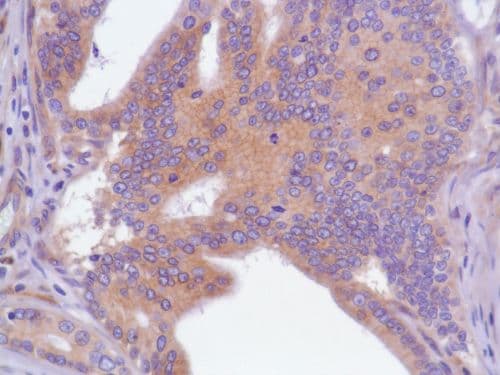 Egfr Antibody Sp84 Bsa And Azide Free Ab238803  Immunohistochemistry Formalin Pfa Fixed Paraffin Embedded Sections Img136796