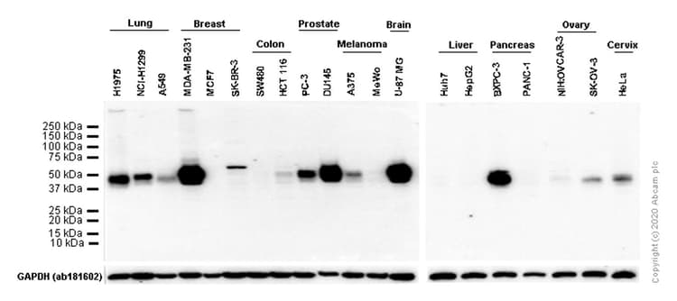 Anti-PD-L1 antibody [EPR19759](AB213524)
