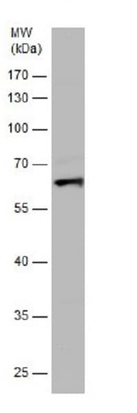 Activin Receptor Type Ia Antibody Ab262699  Western Blot Img157018