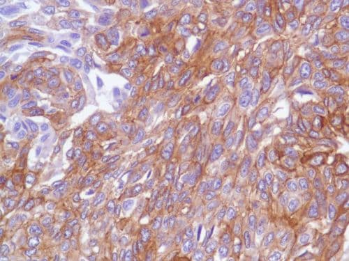 Egfr Antibody Sp84 Bsa And Azide Free Ab238803  Immunohistochemistry Formalin Pfa Fixed Paraffin Embedded Sections Img104482