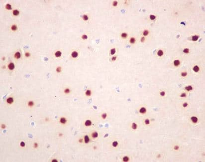 Baf53b Antibody Ep10101 Ab180927  Immunohistochemistry Formalin Pfa Fixed Paraffin Embedded Sections Img121787