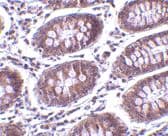 Mica Antibody Ab62540  Immunohistochemistry Formalin Pfa Fixed Paraffin Embedded Sections Img8077