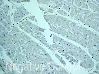 Cyp26a1 Antibody Epr11841 Ab172474  Immunohistochemistry Formalin Pfa Fixed Paraffin Embedded Sections Img133334