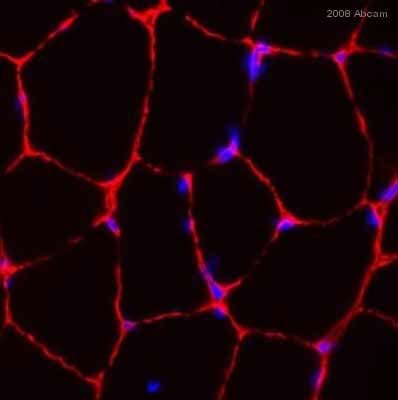 Anti-Laminin 2 alpha antibody [4H8-2](AB11576)
