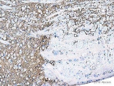 Anti-Synaptophysin antibody [SY38](AB8049)