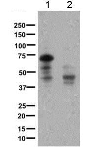 Anti-Somatostatin Receptor 1/SSTR1 antibody [UMB7](AB137083)