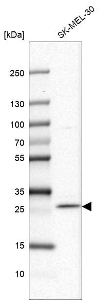 Anti-FAM168A antibody(AB254815)