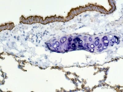 Anti-wide spectrum Cytokeratin antibody(AB9377)