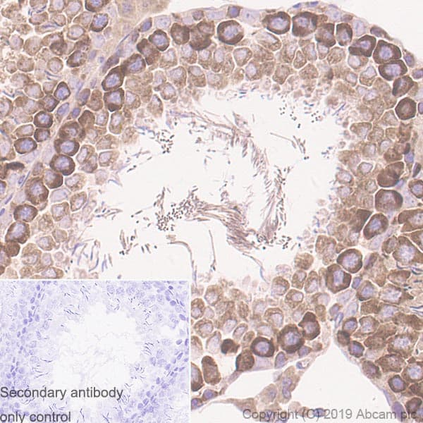Ythdc2 Antibody Epr21820 49 Bsa And Azide Free Ab259277  Immunohistochemistry Formalin Pfa Fixed Paraffin Embedded Sections Img62067